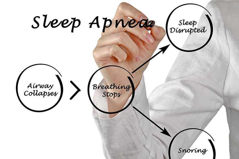 Understanding Common Symptoms Of Sleep Apnea In Seniors The Summit by